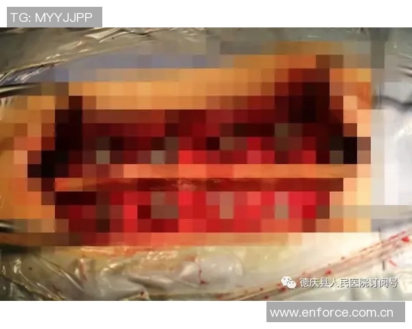 弗兰克透露比尔骨折如同车祸这并非常见篮球伤病